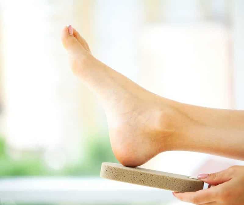 Corns And Calluses How To Get Rid Northwich Foot Clinic